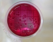 Тест на БГКП (колиформные (колиморфные) бактерии в т.ч. Escherichia coli)